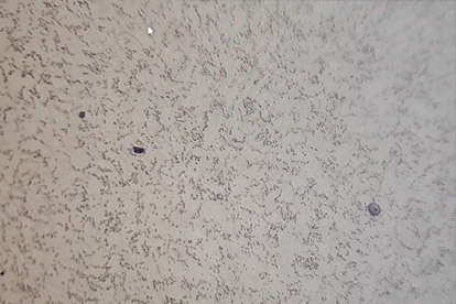 Phát hiện kim loại-500 lần kim loại